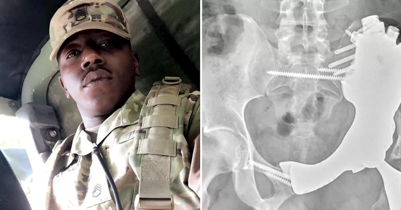 Army Staff Sergeant Beats Rare Cancer, Keeps His Leg Thanks to 3D-Printed Implant