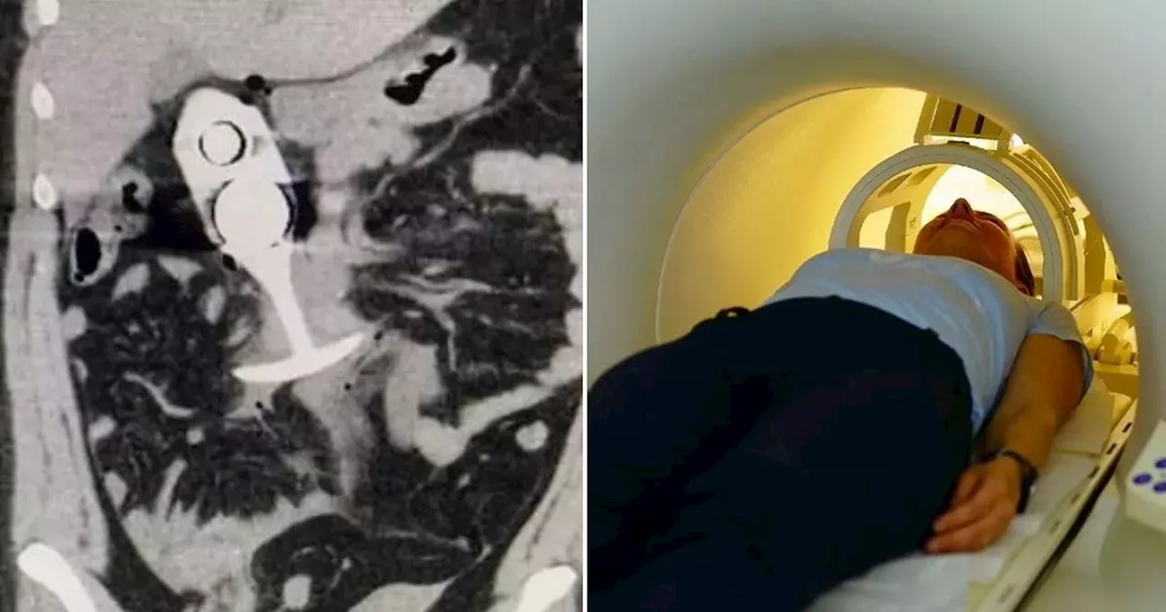 Horrifying MRI Incidents: When Things Go Wrong