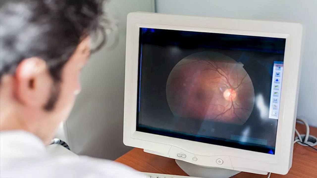 Simple Retinal Scan May Help Predict Stroke Risk