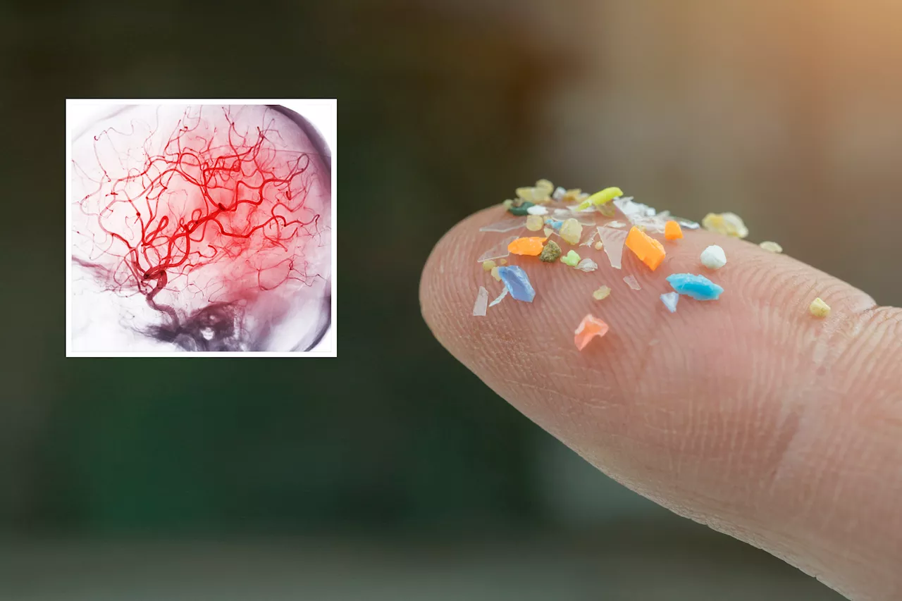 Microplastics May Block Blood Flow in the Brain