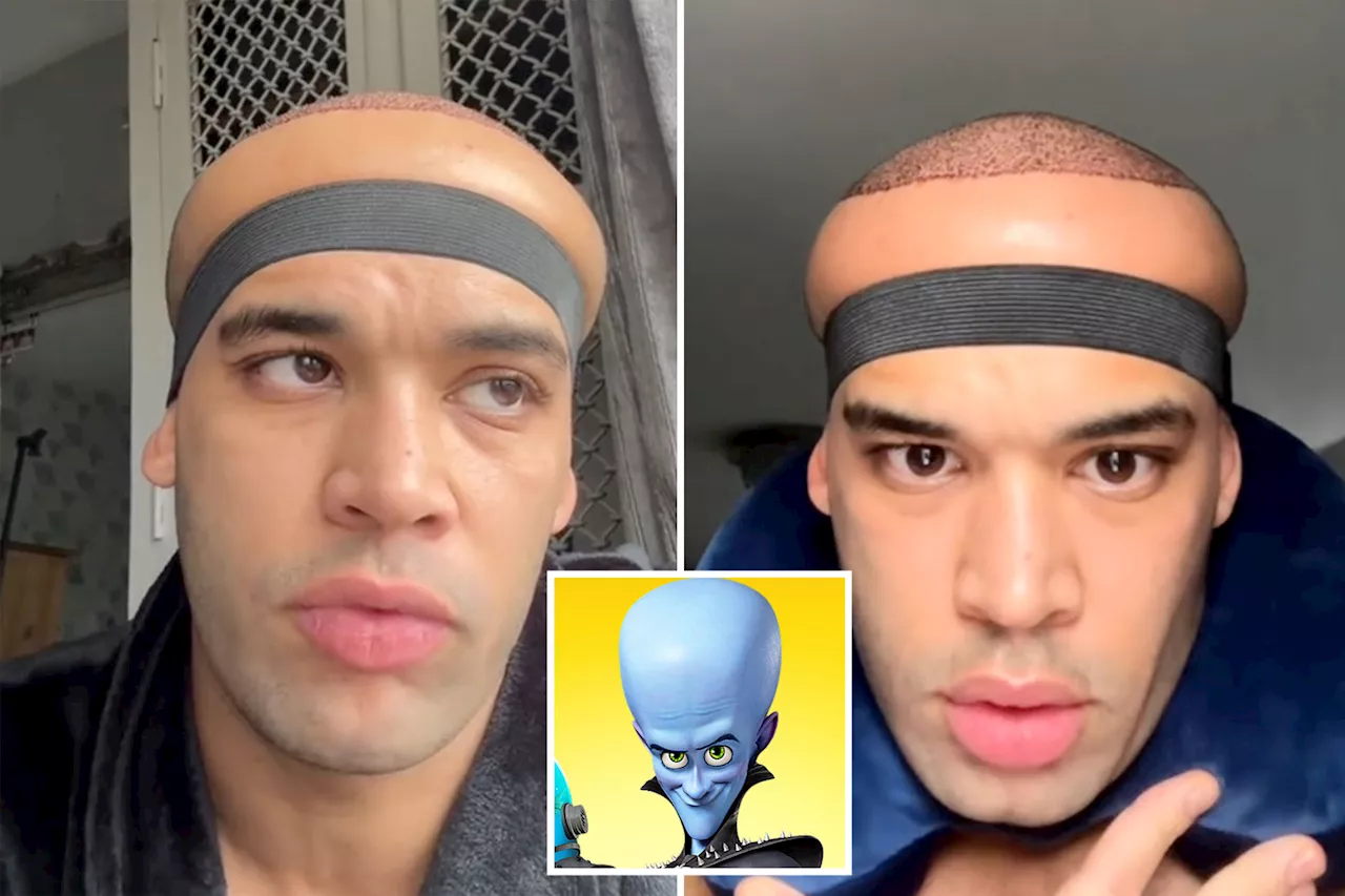 Hair Transplant Gone Wrong? TikTok Star's Dramatic Swelling Sparks Social Media Frenzy