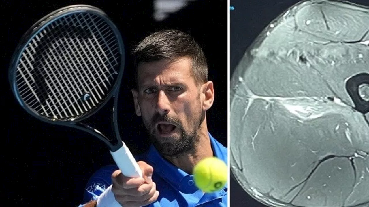 Djokovic Fischiato a Melbourne: Lo Strappo Muscolare e la Reazione di Zverev