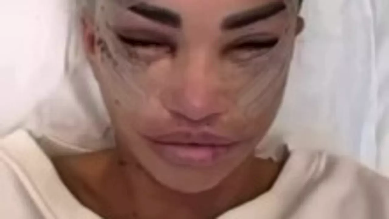 Katie Price Undergoes Another Facelift to Address 'Sticking Out' Ears