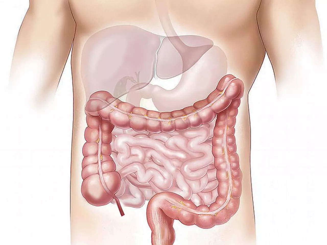 Tumore al colon, uno studio rivela i principali fattori di rischio. I 5 sintomi da riconoscere