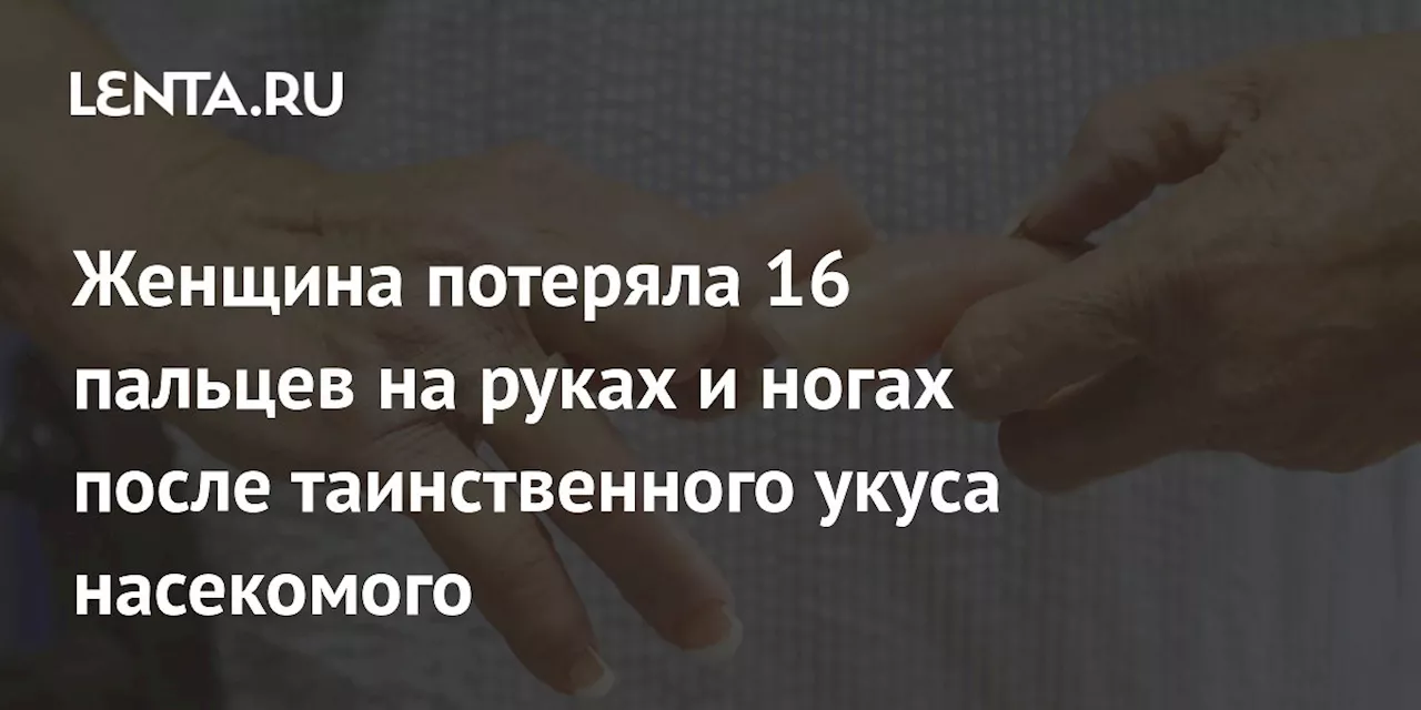 Катрин Эбботт-Кутзее: История сильной женщины, которая смогла найти счастье после ампутации