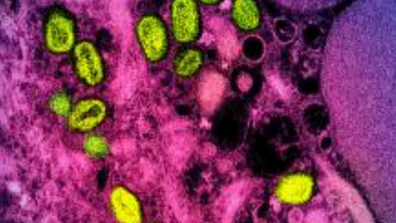 New Deadly Mpox Strain Detected in UK