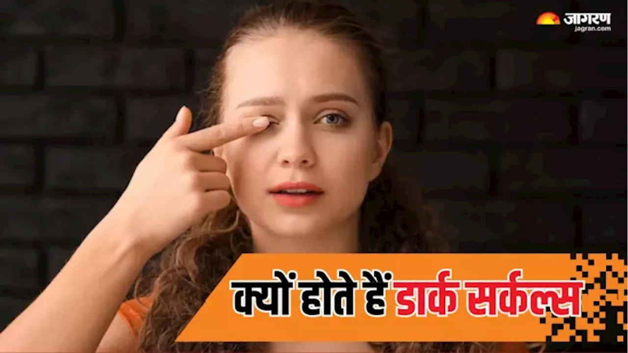 आपकी ये 7 गलत आदतें बन सकती है Dark Circles का कारण, आज से ही कर लें इनमें सुधार