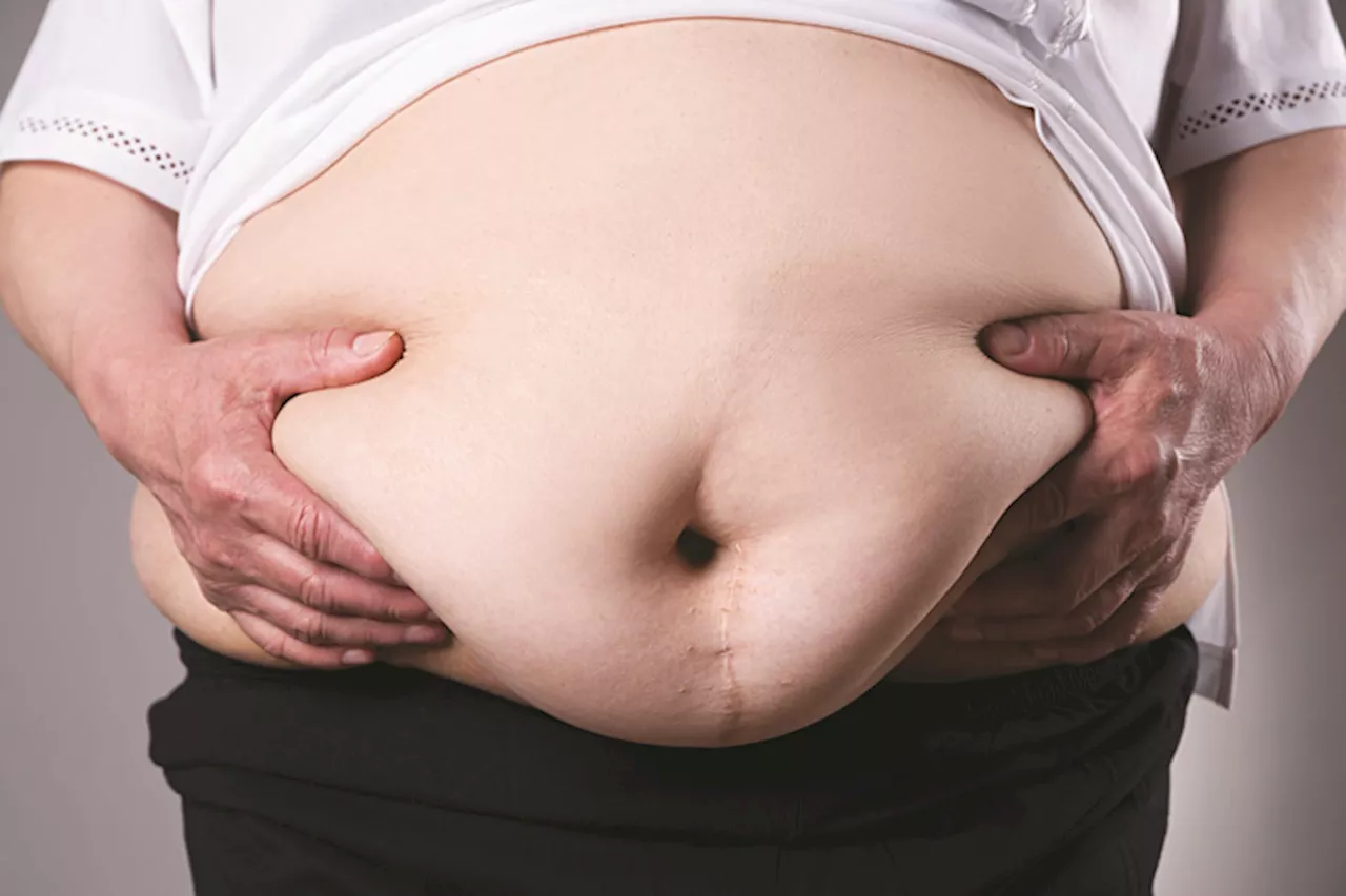 Shifting the Definition of Obesity: Beyond BMI