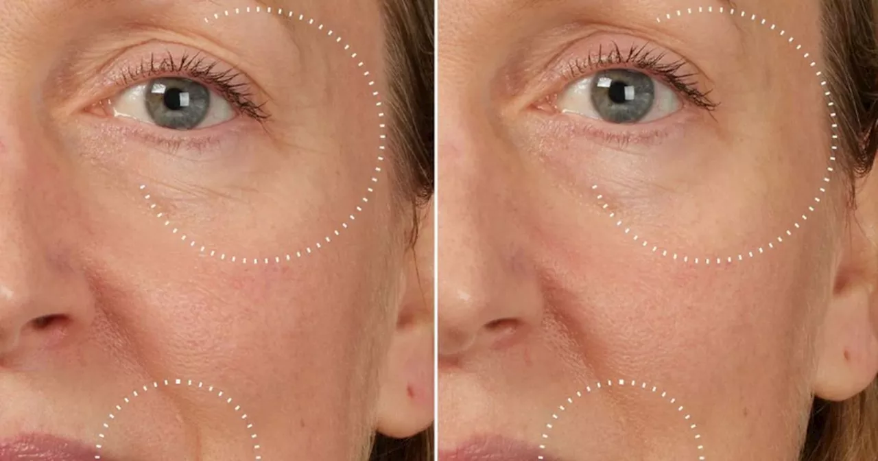 Medik8's New Wrinkle-Reduction Serum Delivers 'Visibly Younger-Looking Skin' in 10 Minutes