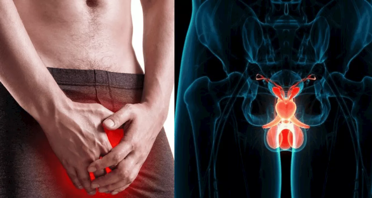 El Alarming Incremento del Cáncer de Pene en el Mundo