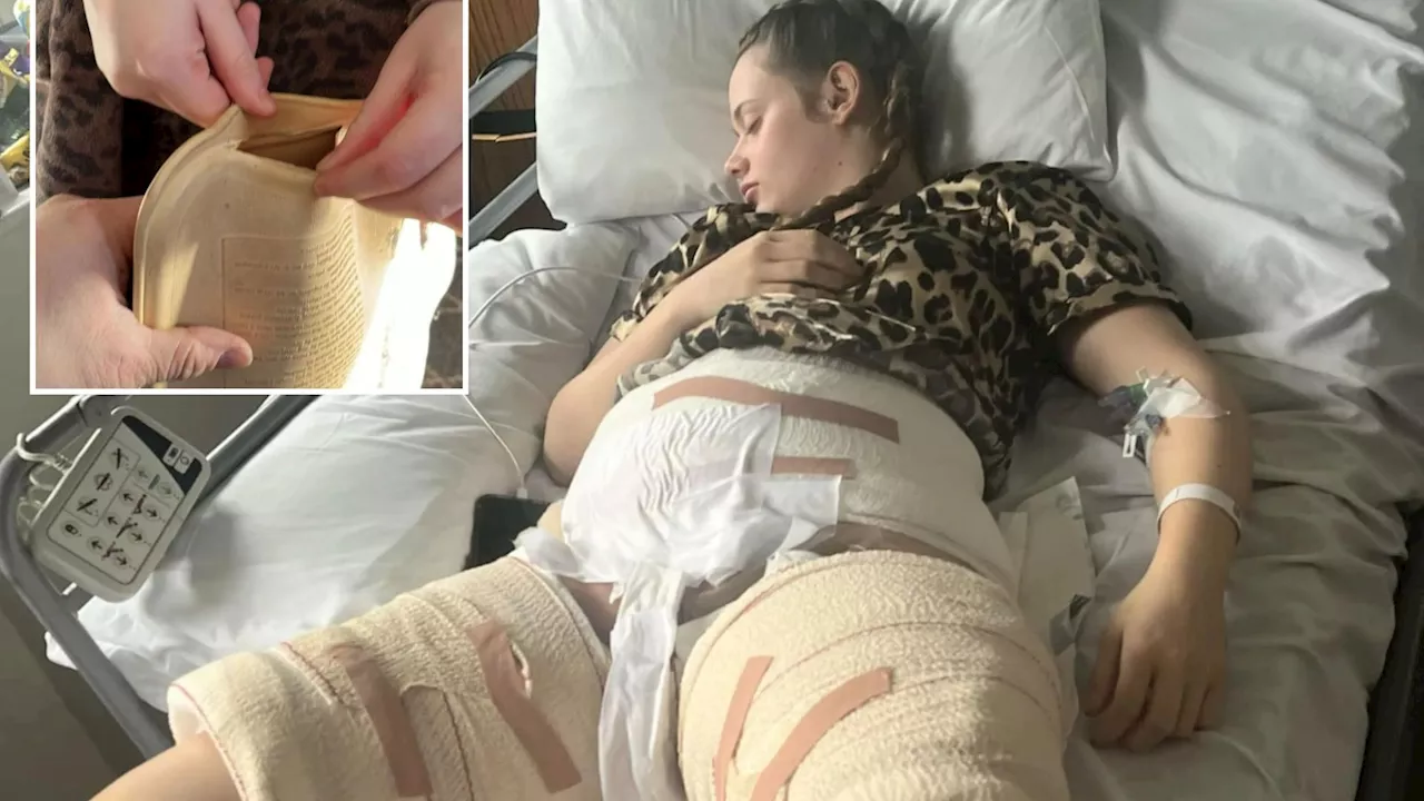 Hot Water Bottle Burns Leave Student Unable to Walk