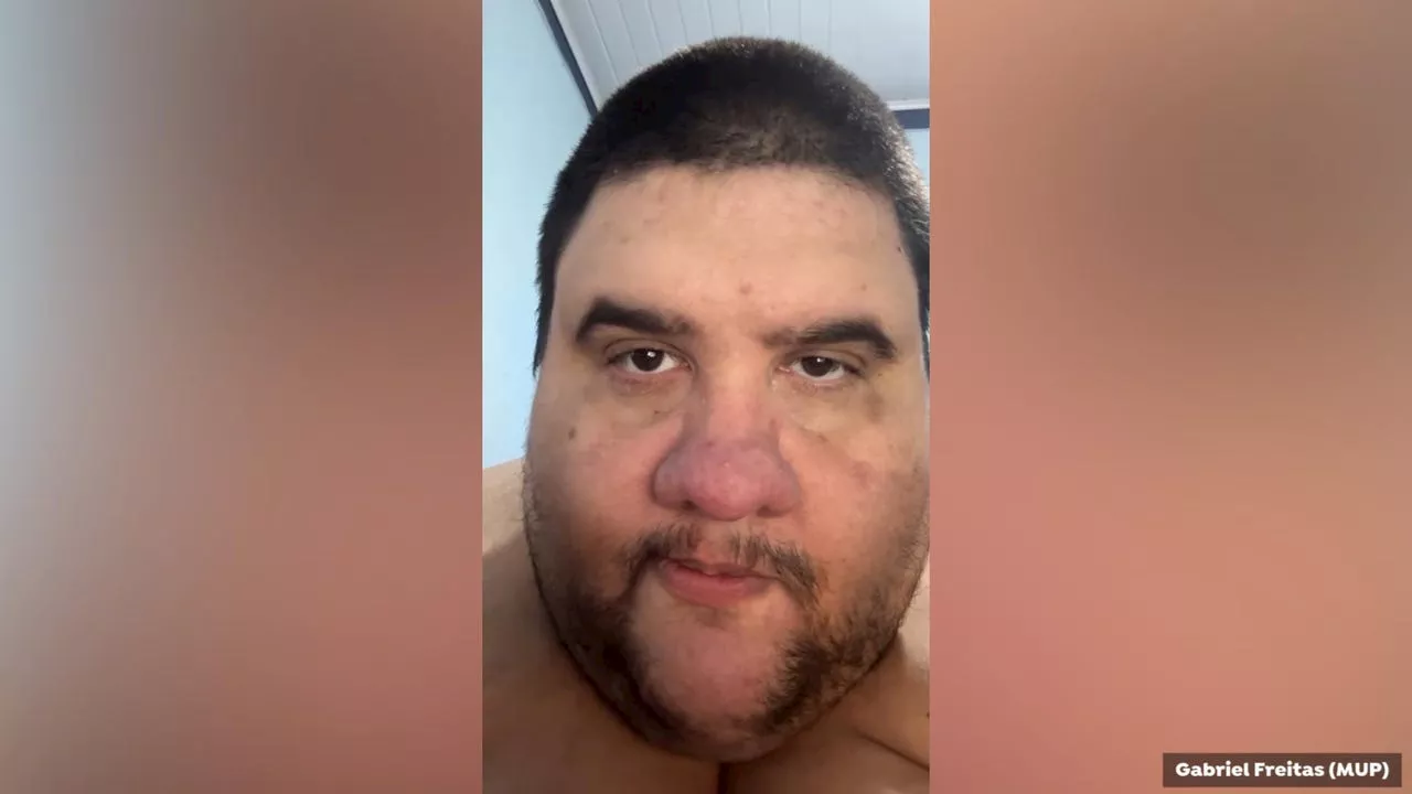 Muere Gabriel Freitas, influencer que pesaba más de 300 kilos tras un fallo cardiorrespiratorio