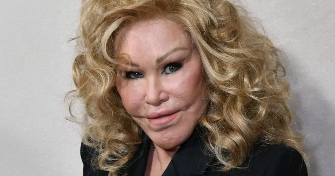 'Catwoman' Jocelyn Wildenstein cause of death revealed after icon dies at 84