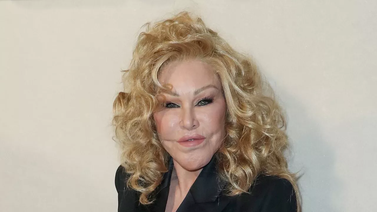 Jocelyn Wildenstein's Fiancé Reveals 'Catwoman' Died From Phlebitis