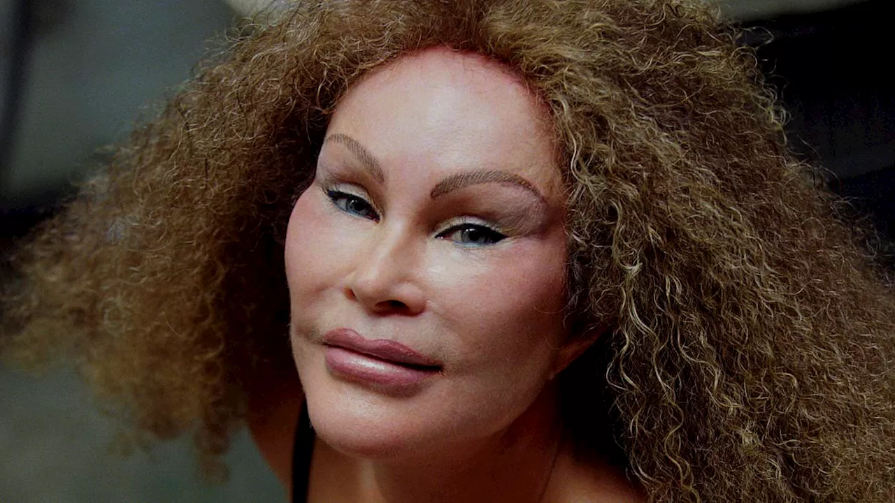 Jocelyn Wildenstein's Feline-Themed Divorce Grips Global Attention