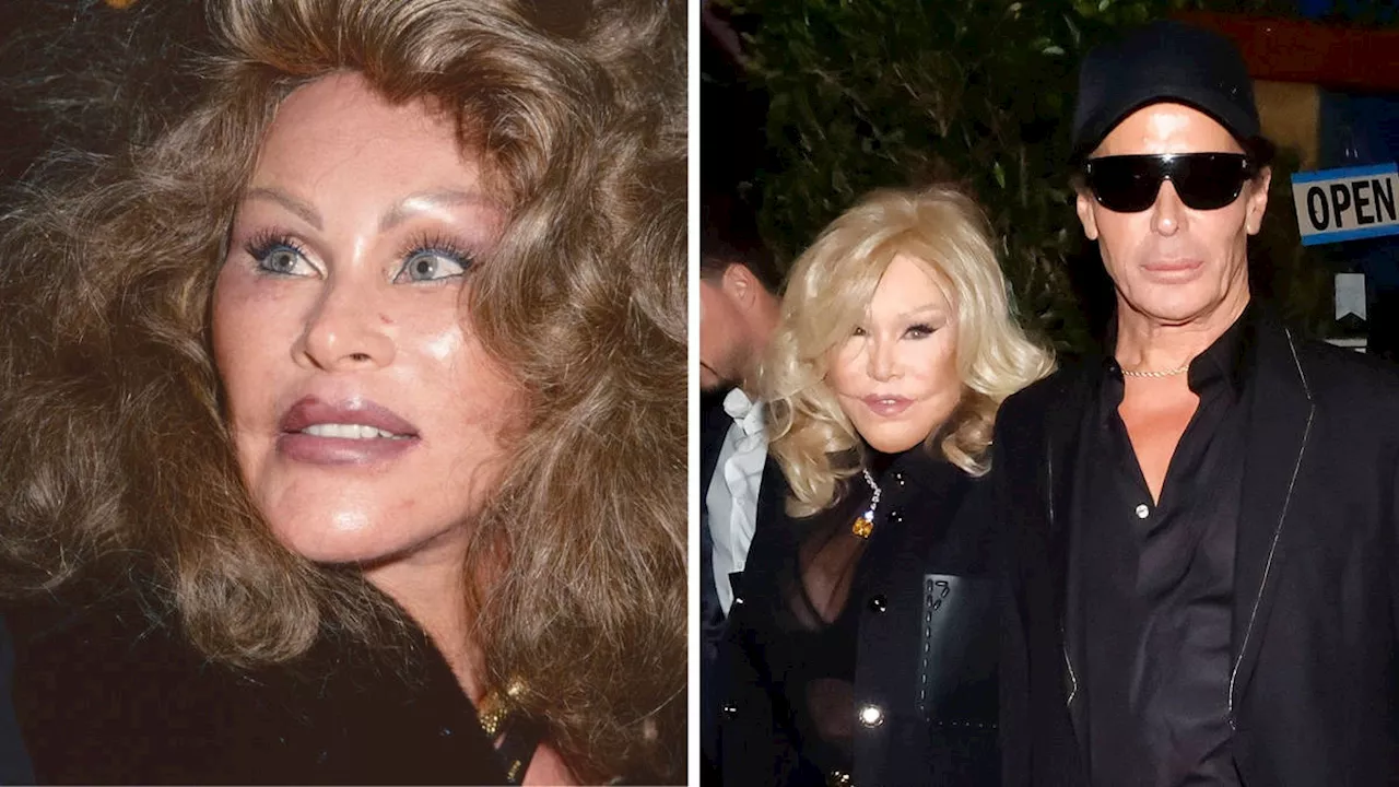 Catwoman' Jocelyn Wildenstein Dies After Battle With Phlebitis