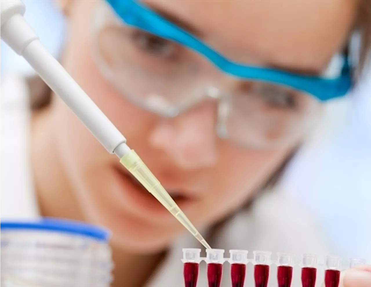 Australian Researchers Develop Novel Blood Test for Endometriosis