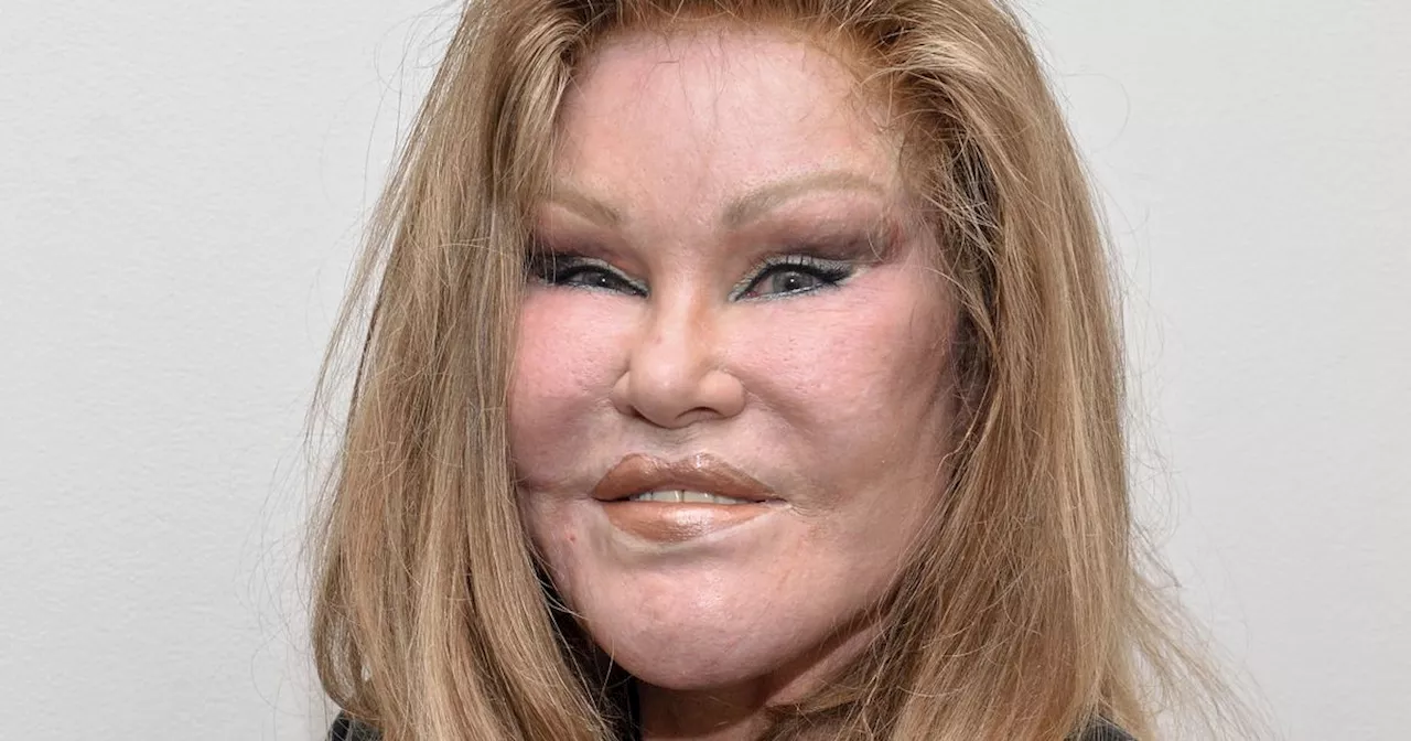 Catwoman' Jocelyn Wildenstein Dies at 84