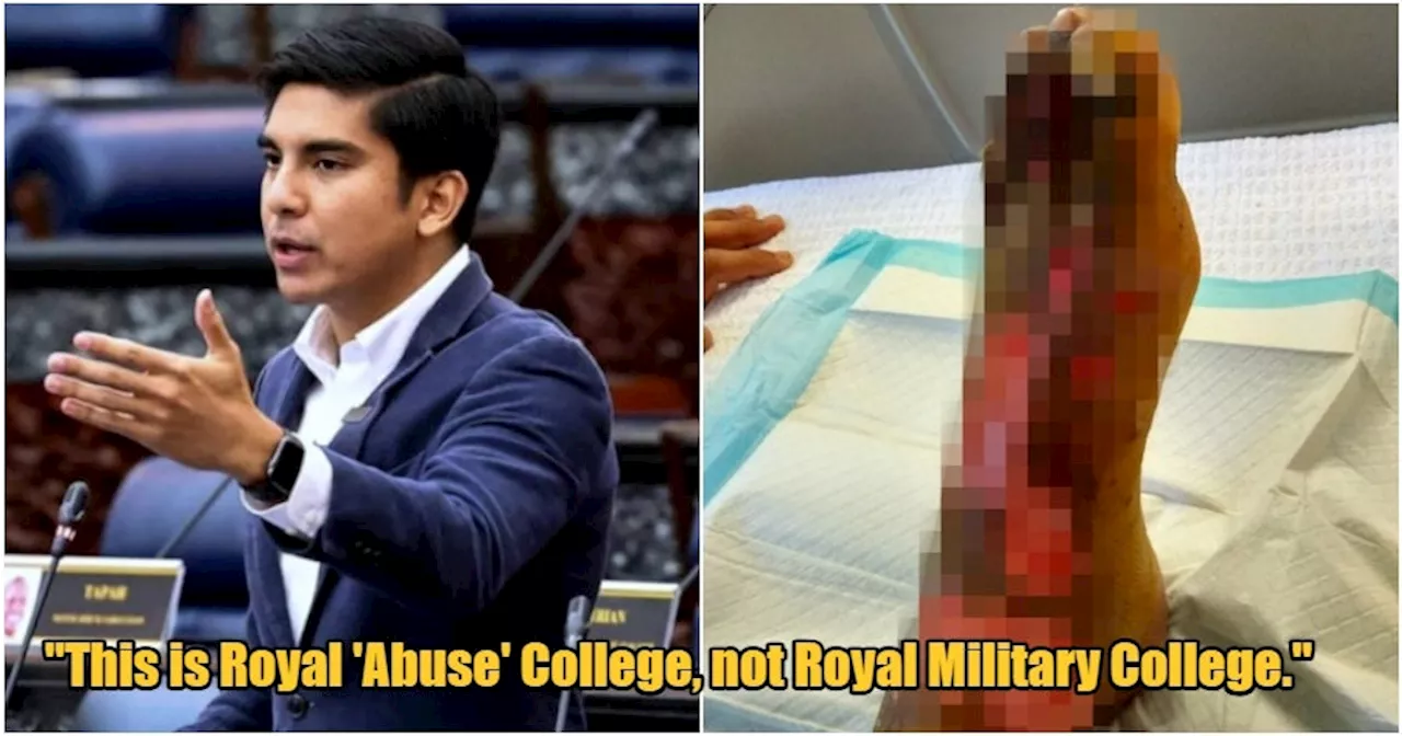 MP Calls for Investigation After Student Allegedly Burned by Coach at Military-Style School