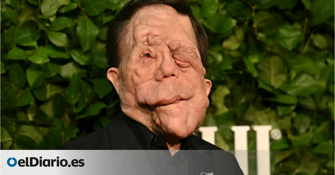 Adam Pearson, el actor con desfiguración facial que desafía las reglas de Hollywood: “El mundo está obsesionado con lo normal”