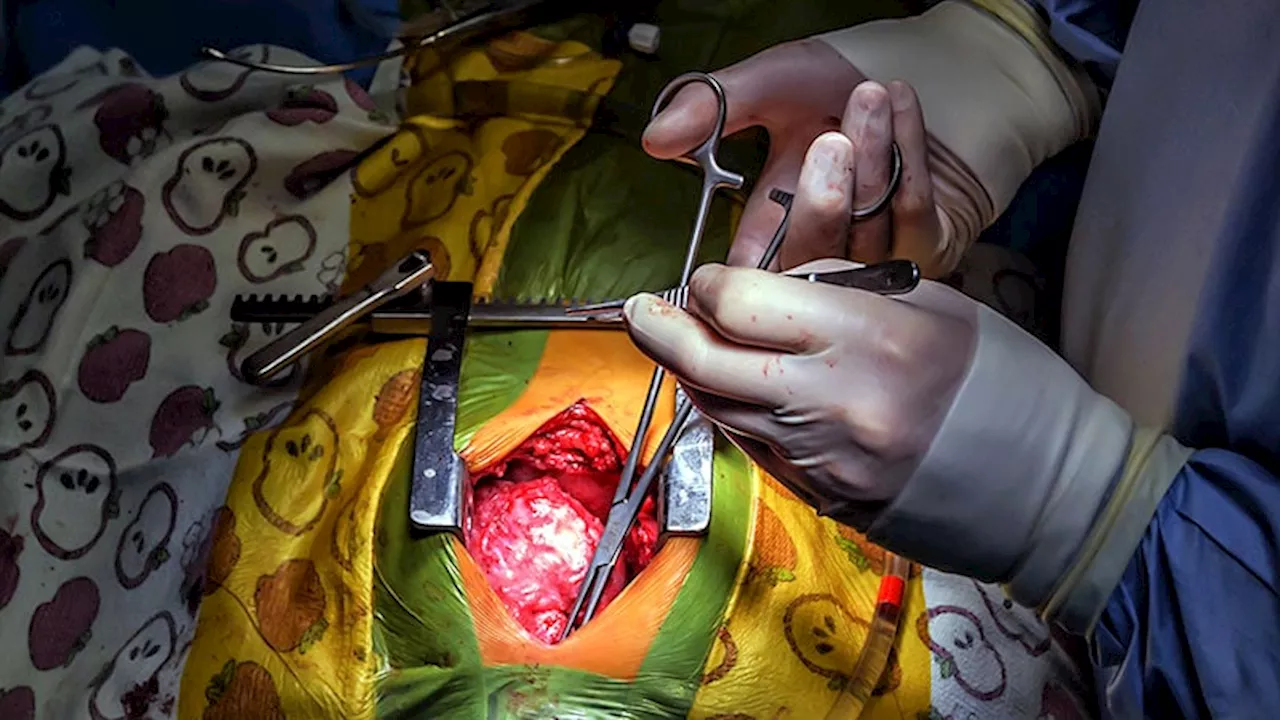 Ross Procedure for Aortic Valve Disease Sees Revival