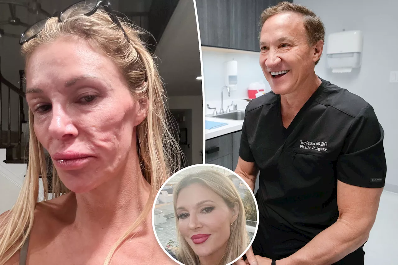 Brandi Glanville Undergoes Biopsy to Diagnose Facial Disfigurement