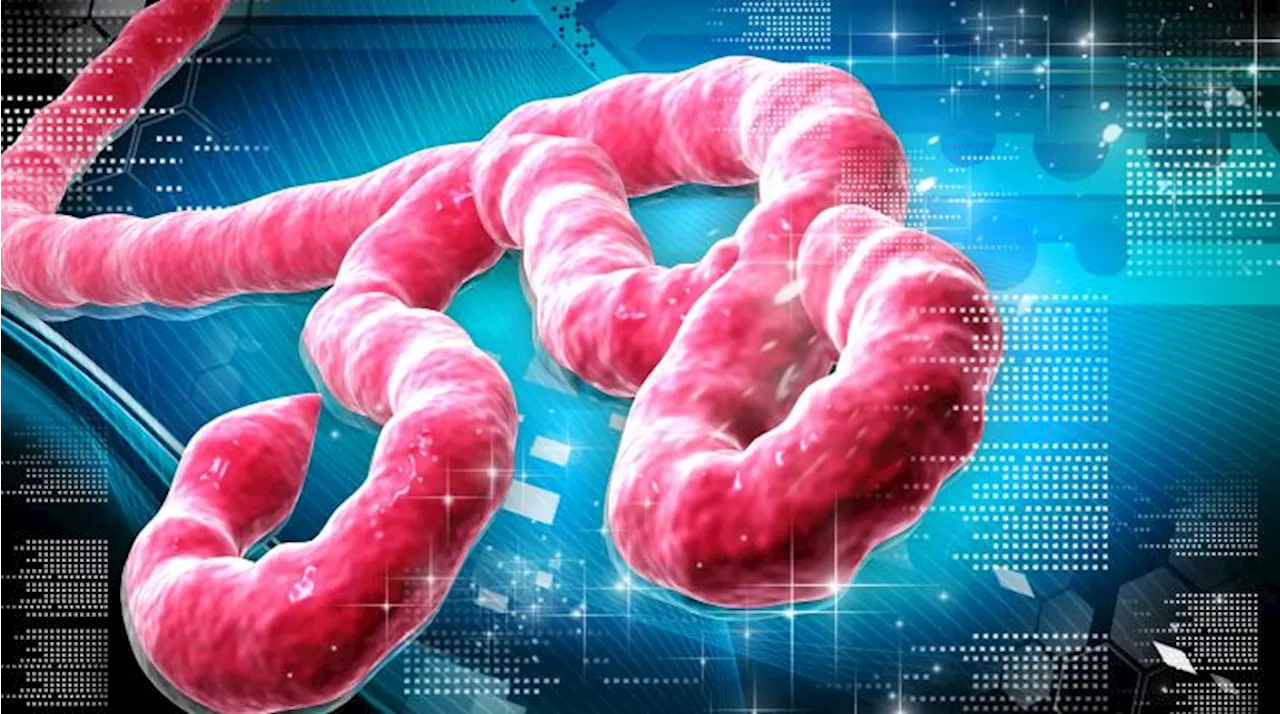 Sudan Ebola Virus Detected in Uganda, WHO Responds with $1 Million