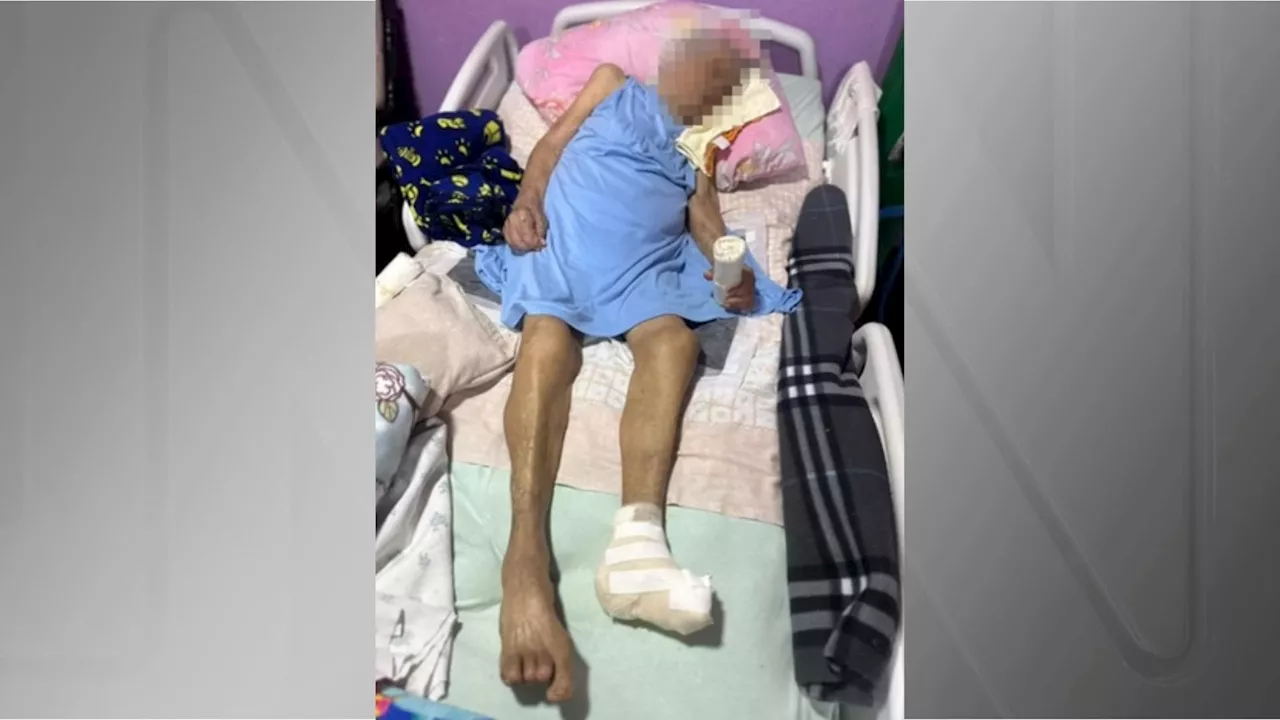 Idose de 103 anos é amputada sem anestesia em casa pelo DF