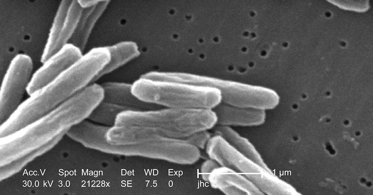 Mycobacterium tuberculosis Bacteria: An Electron Microscope Image