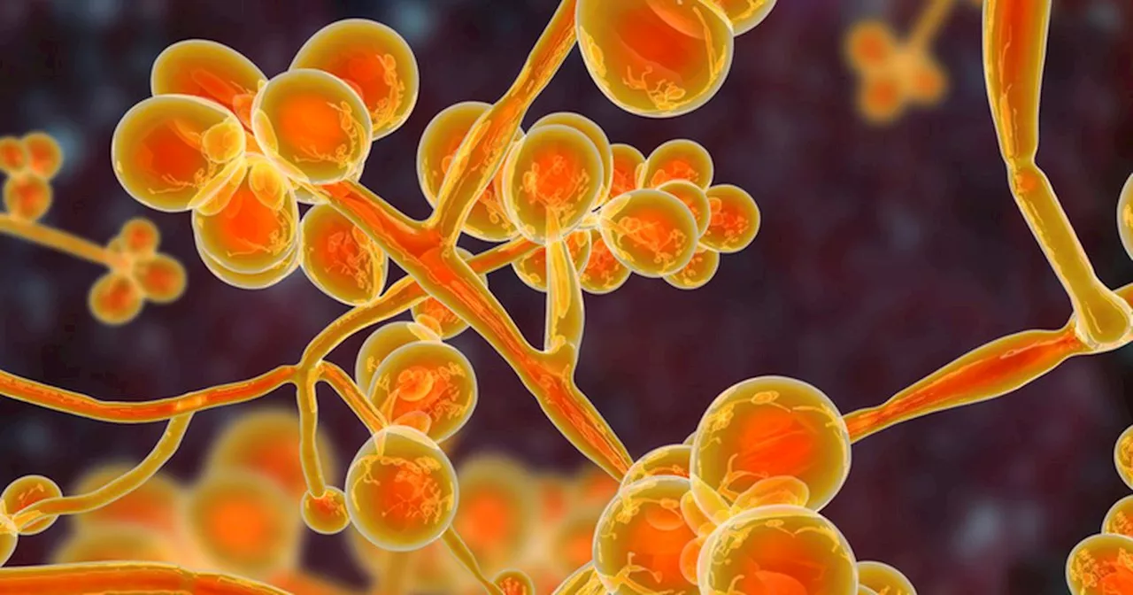 Hidden Killer: Candida auris Raises Concerns in the UK