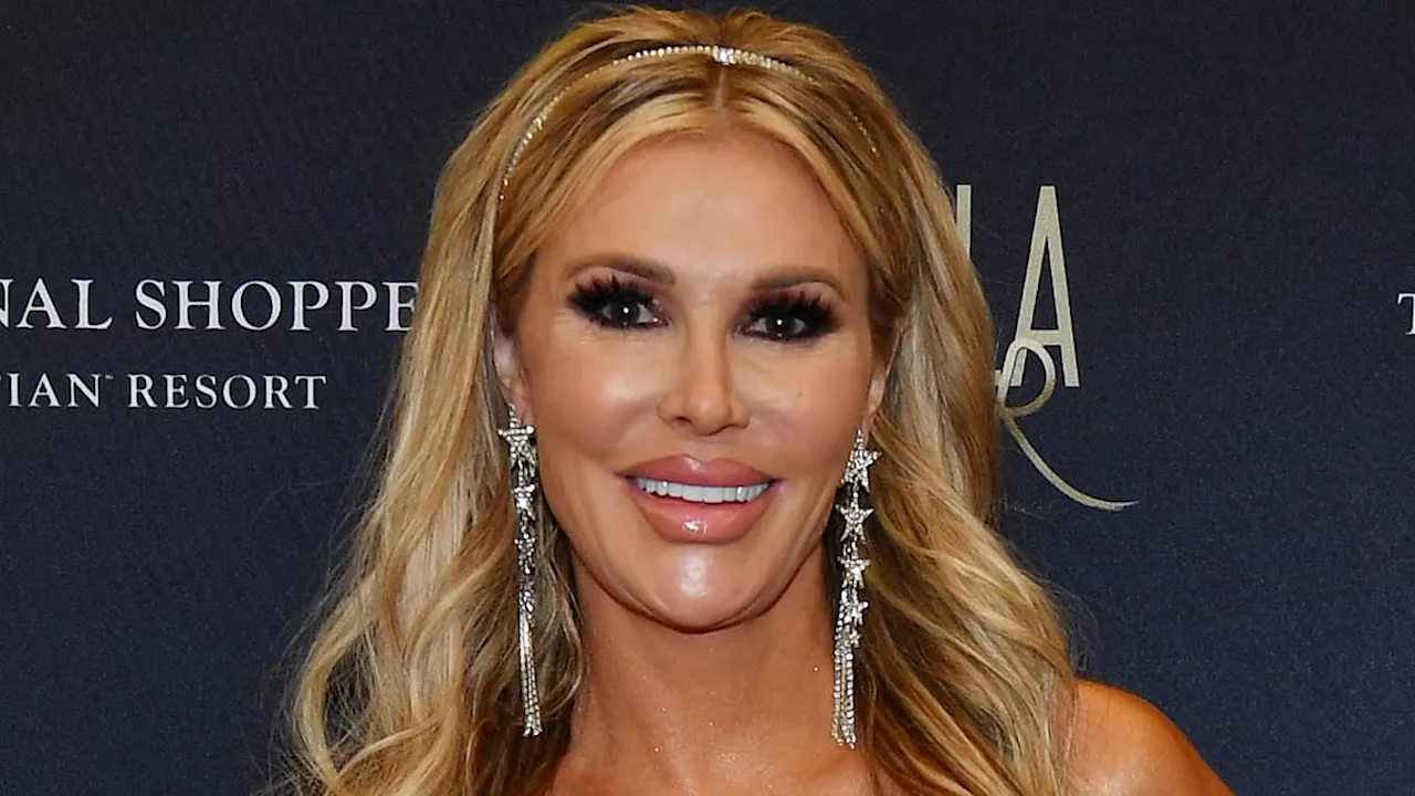 Brandi Glanville Undergoes Biopsies With Dr. Dubrow to Diagnose Facial Disfigurement