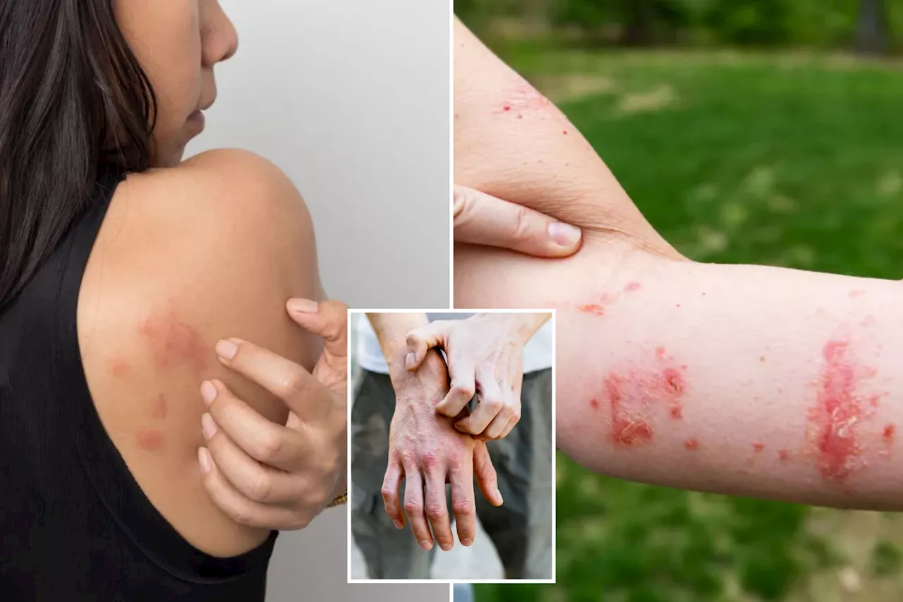 Scratching A Rash: Good Or Bad?