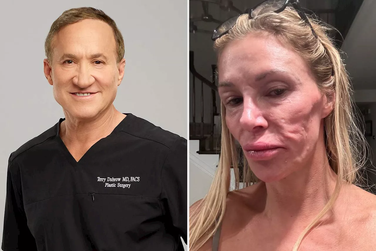 Brandi Glanville Undergoes 4 Biopsies by Botched Star Dr. Terry Dubrow for Her Facial Disfigurement: 'Now We Wait'