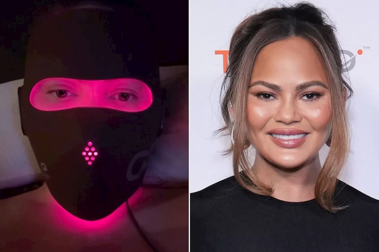 Chrissy Teigen Tries Out a Laser Face Mask for Acne Scars