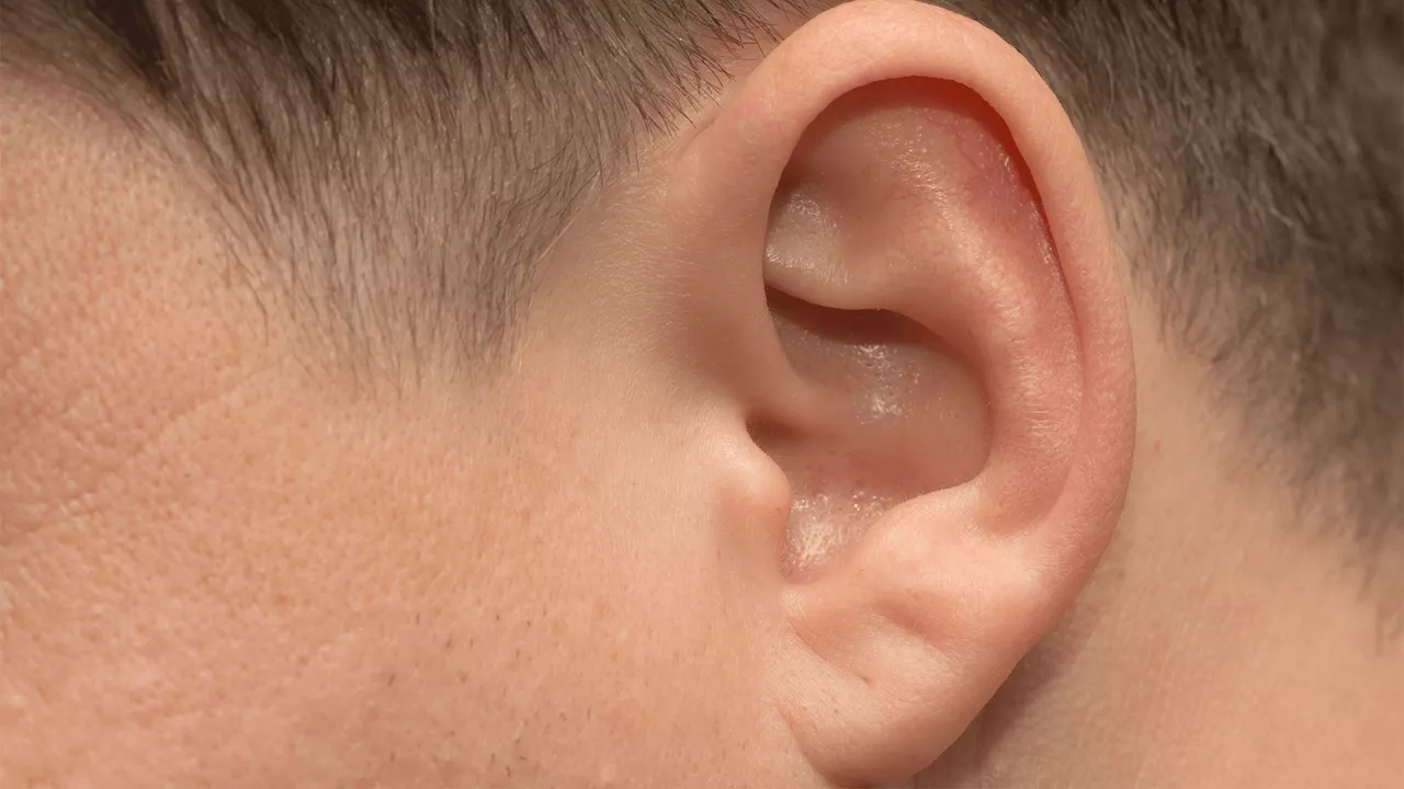 Vestigial Ear Muscles May Play a Role in Effortful Listening