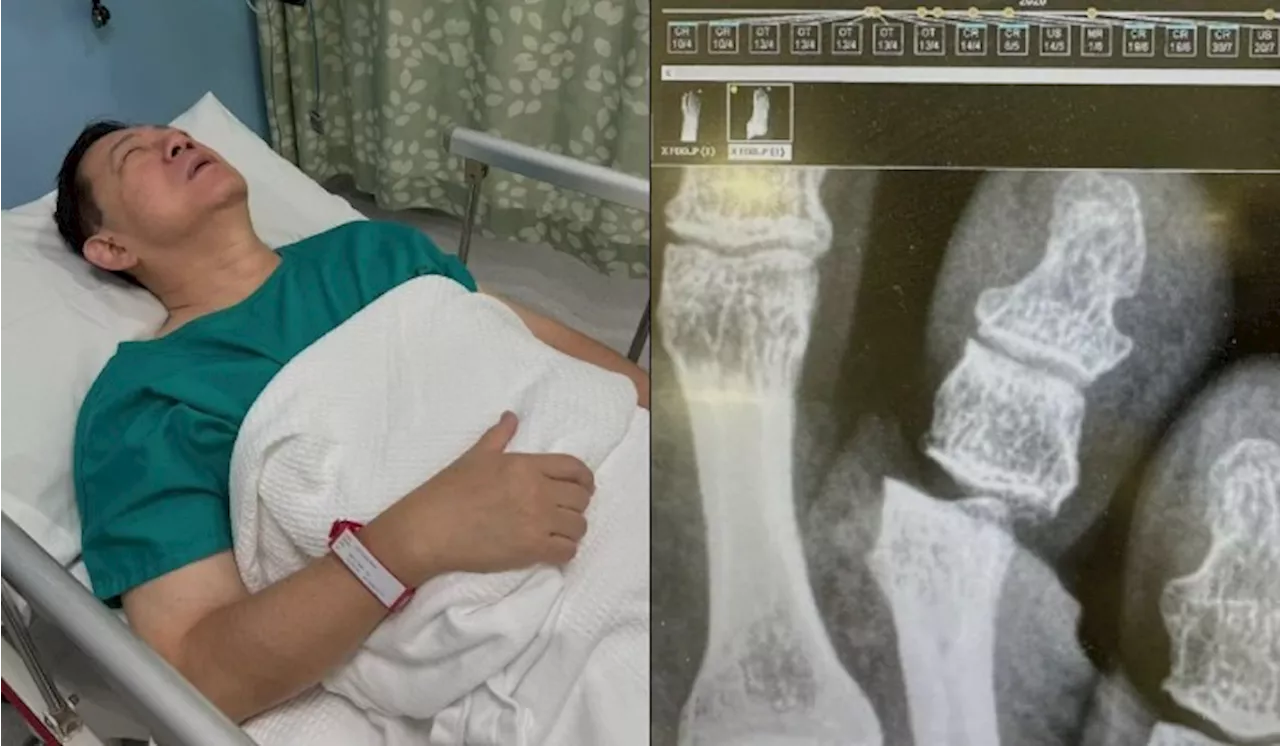 Lim Guan Eng's Dislocated Toe Turns Chinese New Year into a Comedy of Errors