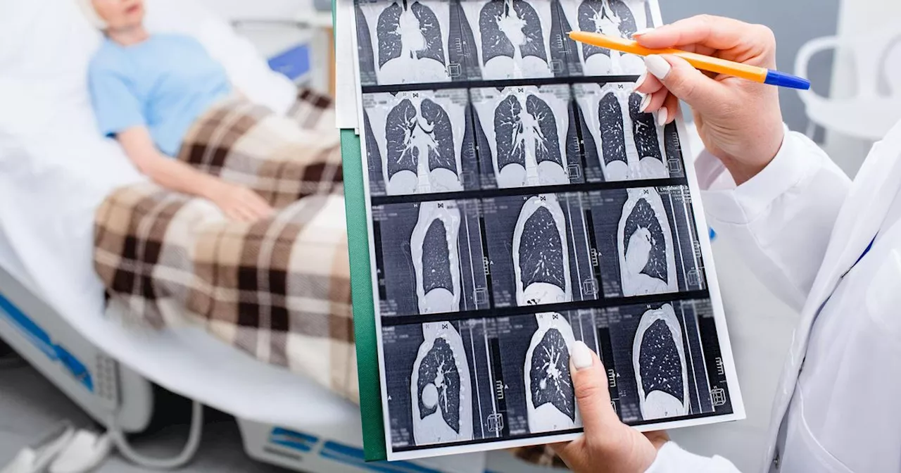 What screenings are available on the NHS to detect cancer early?