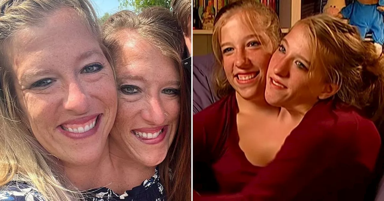 Conjoined Twins Abby and Brittany Hensel Explain Their Shared Body on TikTok