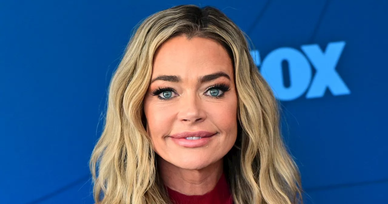 Denise Richards Says She ‘Ruptured’ Her Breast Implants On ‘Special Forces’