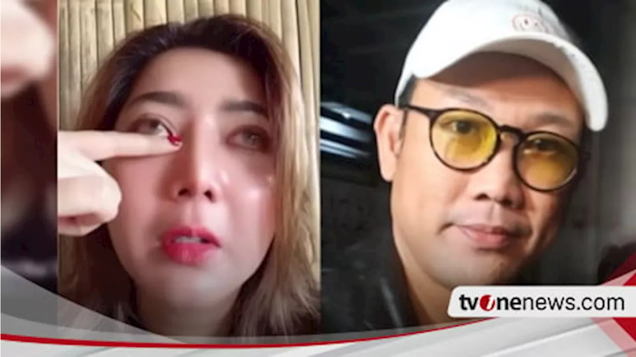 Pratiwi Noviyanthi Akui Lelah Diadu Domba, Hubungan dengan Denny Sumargo Kini...