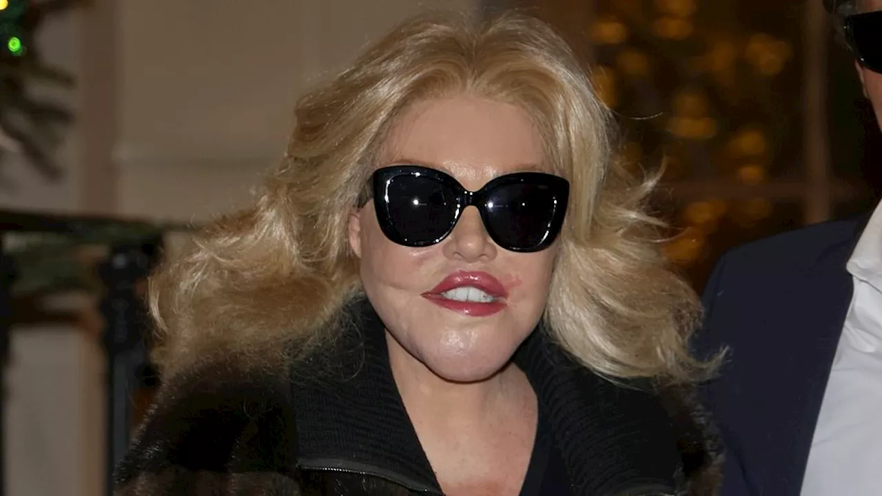 Catwoman' Jocelyn Wildenstein Spent Last Months in £13,000-a-Week Paris Hotel Suite