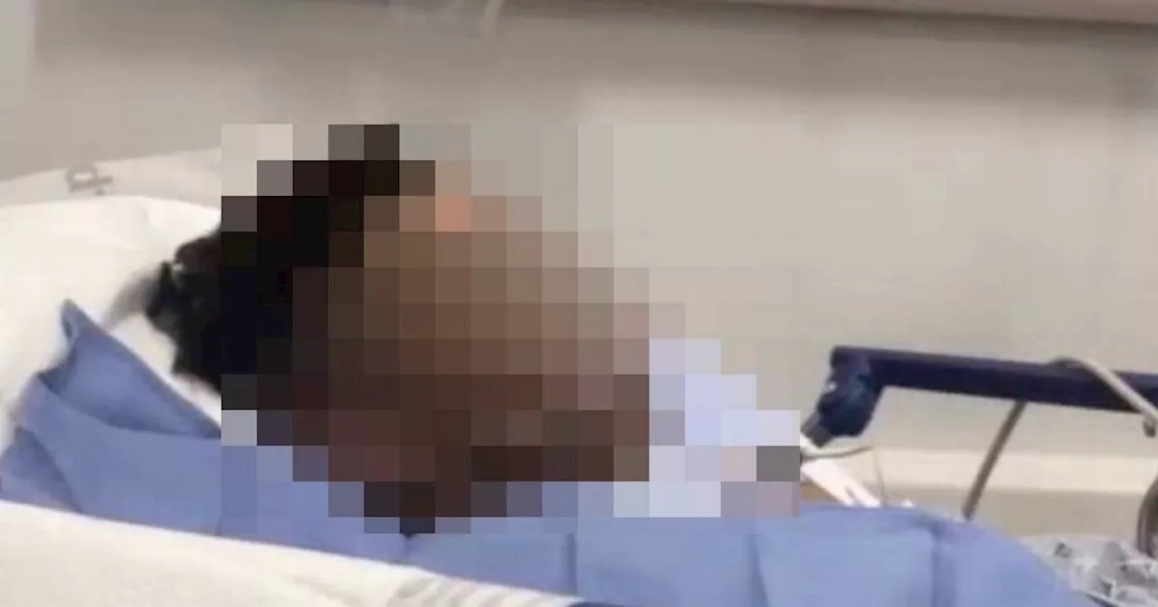 Boy, 12, Left With Severe Burns After 'Prank' Goes Horribly Wrong