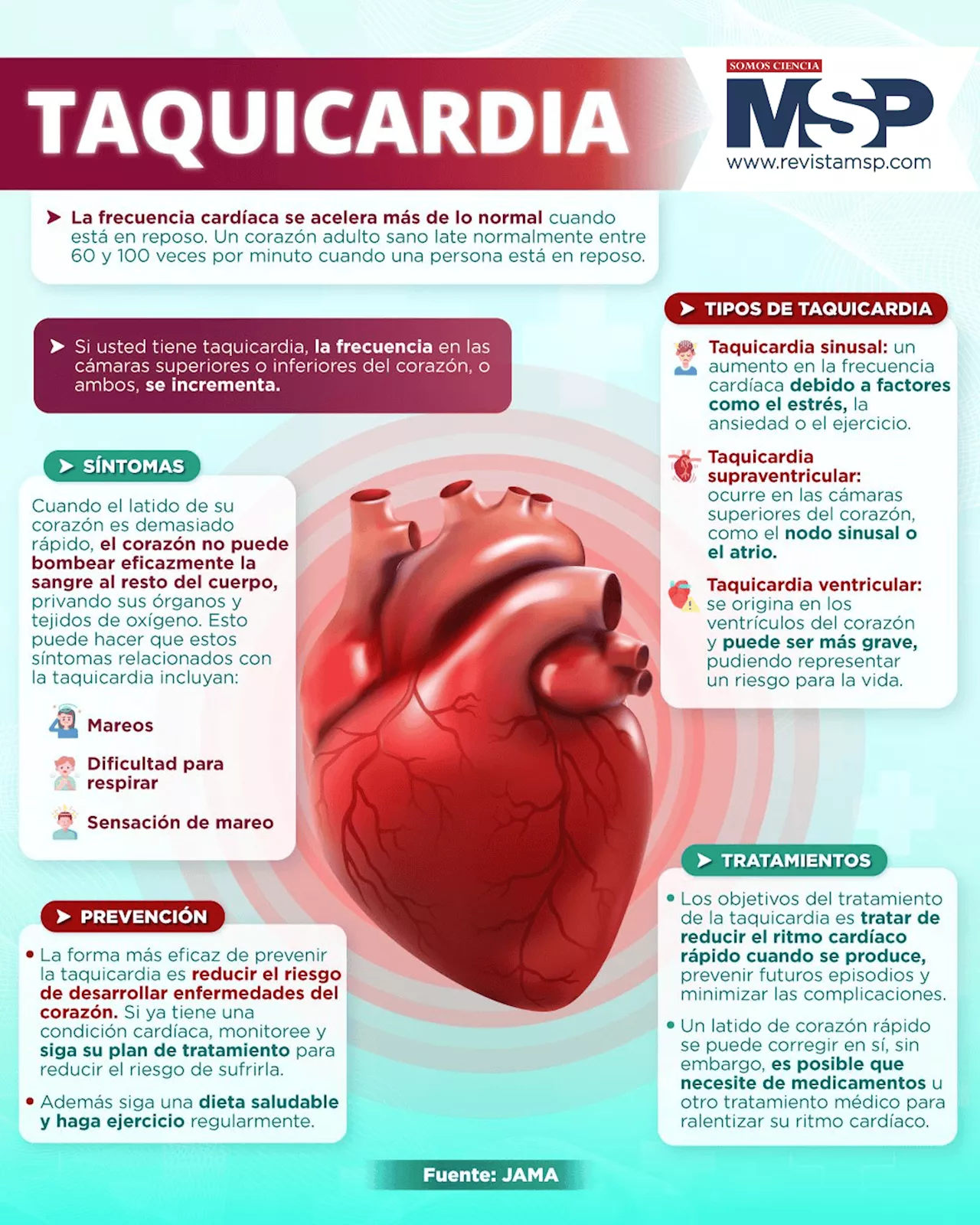 Taquicardia: causas y tipos