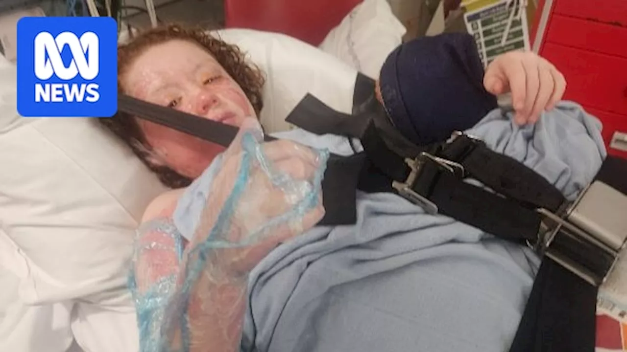 Girl Suffers Severe Burns From Flammable Online Purchase