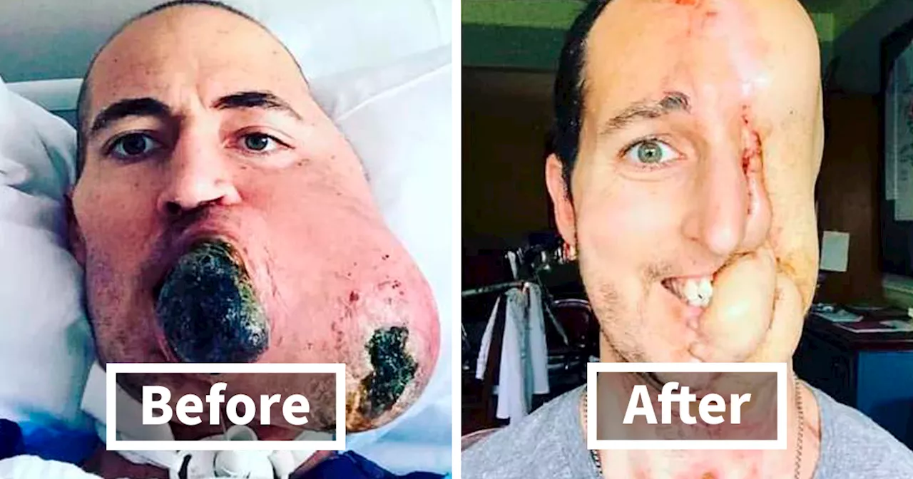 50 Interesting Medical Cases That Might Make You Appreciate The Human Body (New Pics)