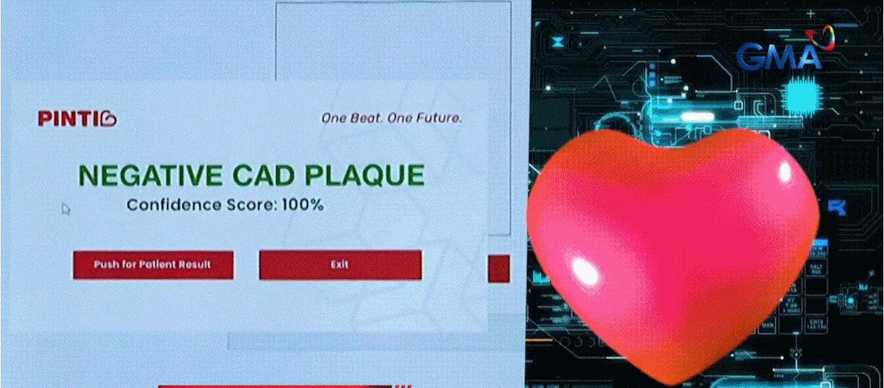 AI software to detect heart plaque developed by Grade 11 students