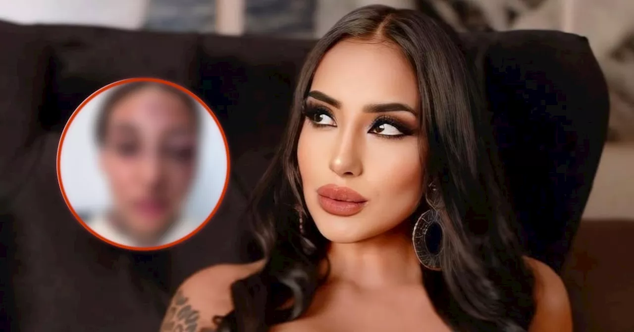 Modelo de OnlyFans denuncia violencia por parte de su pareja