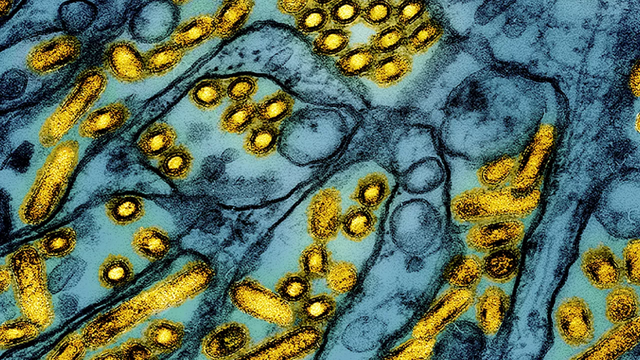 Louisiana person is the first US bird flu death, health officials say