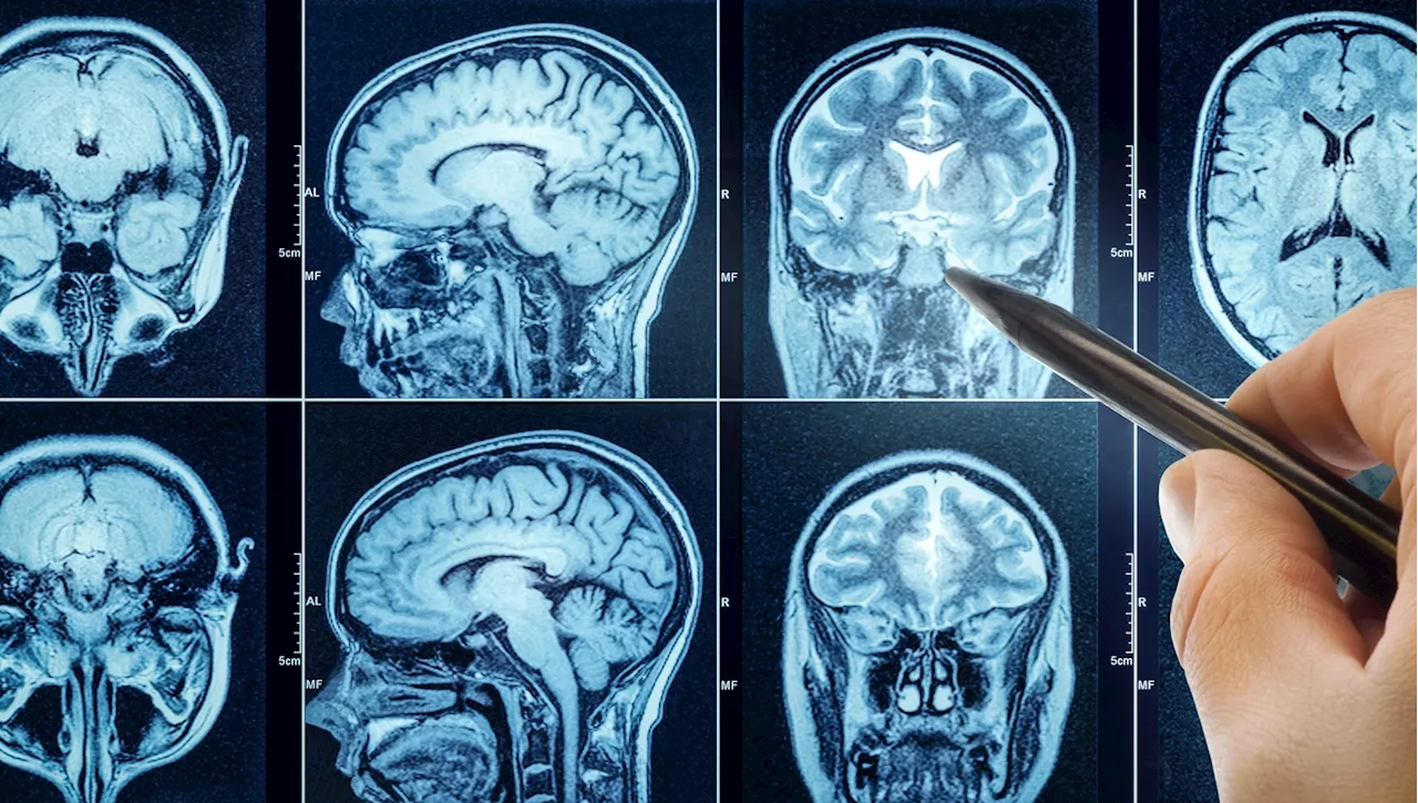 Maux de tête violents : Quels signes d'alarme ne pas ignorer ?