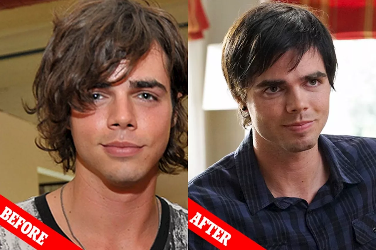 When Dylan Reid Ewing revealed his struggles with plastic surgery to look like Brad Pitt